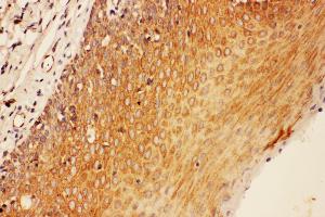 Anti-SOCS3 antibody, IHC(P) IHC(P): Human Tonsil Tissue (SOCS3 anticorps  (Middle Region))