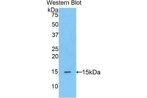 Western Blotting (WB) image for anti-Peroxisome Proliferator-Activated Receptor delta (PPARD) (AA 29-147) antibody (ABIN1175443) (PPARD anticorps  (AA 29-147))