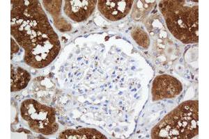 Image no. 4 for anti-Selenium Binding Protein 1 (SELENBP1) antibody (ABIN1500864)