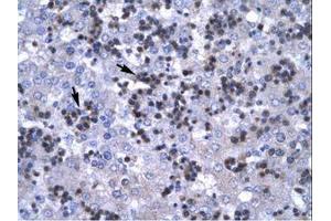 Image no. 1 for anti-Recombination Signal Binding Protein For Immunoglobulin kappa J Region (RBPJ) (C-Term) antibody (ABIN6735782)