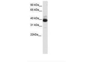 Image no. 1 for anti-Tetratricopeptide Repeat Domain 19 (TTC19) (C-Term) antibody (ABIN202316) (TTC19 anticorps  (C-Term))