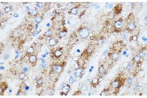 Immunohistochemistry of paraffin-embedded Human liver using IGF2BP3 Polyclonal Antibody at dilution of 1:100 (40x lens). (IGF2BP3 anticorps)