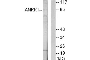 Western blot analysis of extracts from HeLa cells, using ANKK1 antibody. (ANKK1 anticorps)
