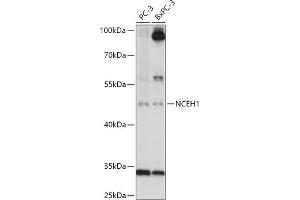 Western blot analysis of extracts of various cell lines, using NCEH1 antibody (ABIN7268897) at 1:1000 dilution.