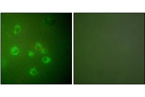 Immunofluorescence analysis of COS7 cells, using GRP78 antibody. (GRP78 anticorps)
