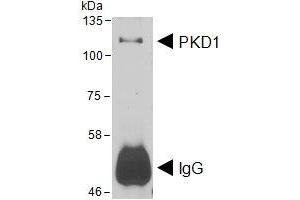 HEK293 lysate overexpressing Human DYKDDDDK-tagged PKD1 was used to immunoprecipitate PKD1 with 2ug ABIN4902745. (PKC mu anticorps)