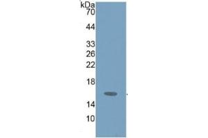 WB of Protein Standard: different control antibodies against Highly purified E. (HEXB Kit ELISA)