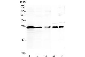Western blot testing of 1) human Jurkat, 2) human K562, 3) human Raji, 4) rat thymus and 5) mouse thymus lysate with IL-36 alpha antibody at 0.