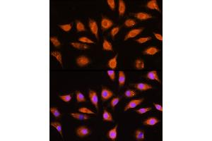 Immunofluorescence analysis of L929 cells using [KO Validated] GN Rabbit pAb (ABIN6132024, ABIN6141204, ABIN6141206 and ABIN7101418) at dilution of 1:100 (40x lens).