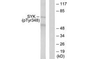 Western blot analysis of extracts from COS7 cells treated with EGF 200ng/ml 30', using SYK (Phospho-Tyr348) Antibody.