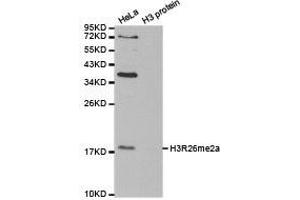Western blot analysis of extracts of HeLa cell line and H3 protein expressed in E. (Histone anticorps)
