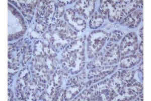 Image no. 15 for anti-DEAD (Asp-Glu-Ala-Asp) Box Polypeptide 59 (DDX59) (AA 1-303) antibody (ABIN1490728) (DDX59 anticorps  (AA 1-303))