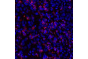 Immunofluorescence (IF) image for anti-CD8a Molecule (CD8A) (AA 185-235) antibody (ABIN7449561)