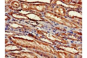 Immunohistochemistry of paraffin-embedded human kidney tissue using ABIN7142512 at dilution of 1:100 (RPS2 anticorps  (AA 2-61))