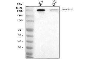 Western blot analysis of NRAP using anti-NRAP antibody (ABIN7599006).