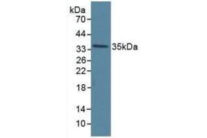 Detection of ANXA5 in Human Hela Cells using Polyclonal Antibody to Annexin V (ANXA5)