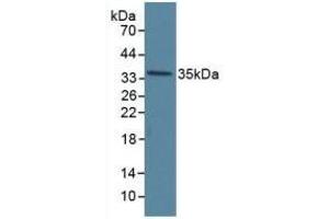 Detection of ANXA5 in Human Hela Cells using Polyclonal Antibody to Annexin V (ANXA5) (Annexin V anticorps  (AA 1-320))