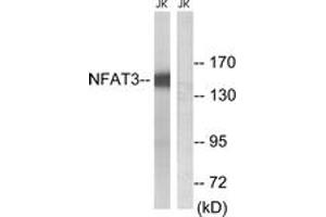 Western blot analysis of extracts from Jurkat cells, using NFAT3 (Ab-168/170) Antibody.