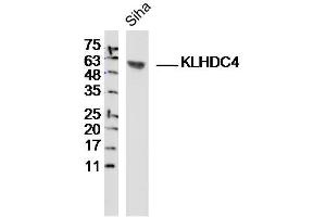 Siha lysates probed with KLHDC4 Polyclonal Antibody, Unconjugated  at 1:300 dilution and 4˚C overnight incubation. (KLHDC4 anticorps  (AA 201-300))
