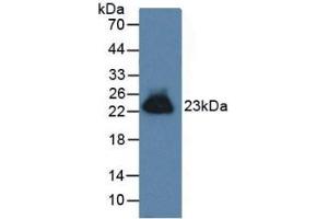 Detection antibody from the kit in WB with Positive Control:  Sample Human prostate tissue. (GREM1 Kit ELISA)
