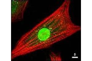 Immunofluorescence Microscopy: Rabbit anti-AKT antibody was used at a 1/80 dilution to stain cultured neonatal Rat cardiomyocytes that express a nuclear-targeted AKT construct. (AKT1 anticorps  (C-Term))