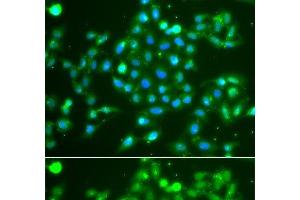 Immunofluorescence analysis of A549 cells using UCHL5 Polyclonal Antibody (UCHL5 anticorps)