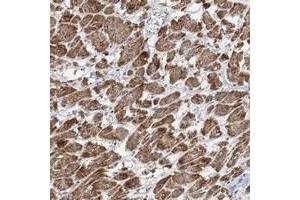 Immunohistochemical staining of human heart muscle with PPP2R3A polyclonal antibody  shows distinct cytoplasmic positivity in myocytes at 1:50-1:200 dilution. (PPP2R3A anticorps)
