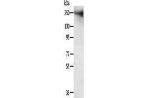 Gel: 6 % SDS-PAGE, Lysate: 40 μg, Lane: Mouse muscle tissue, Primary antibody: ABIN7192726(TACC2 Antibody) at dilution 1/300, Secondary antibody: Goat anti rabbit IgG at 1/8000 dilution, Exposure time: 5 minutes (TACC2 anticorps)