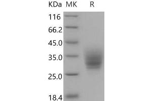 Western Blotting (WB) image for Basigin (Ok Blood Group) (BSG) (AA 1-209) protein (His tag) (ABIN7320310)