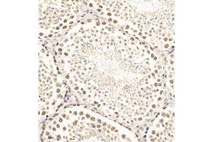 Immunohistochemistry of paraffin embedded mouse testis using SCP1 (ABIN7075786) at dilution of 1:500 (300x lens)