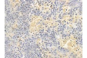 anti-Dynactin 3 (p22) (Dctn3) (N-Term) antibody