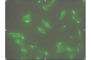 Immunofluorescence staining of human LNCap cell colony with monoclonal anti- human STEAP1 antibody (J2D2)