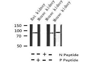 Western blot analysis of Phospho-Cortactin (Tyr466) expression in various lysates