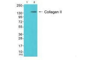 Western blot analysis of extracts from 3T3 cells (Lane 2), using Collagen II antiobdy. (COL2A1 anticorps)