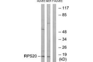 Western blot analysis of extracts from HuvEc/MCF-7 cells, using RPS20 Antibody. (RPS20 anticorps  (AA 31-80))