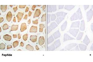 Immunohistochemistry analysis of paraffin-embedded human skeletal muscle tissue using ACTN2/ACTN3 polyclonal antibody . (ACTN2 anticorps  (N-Term))