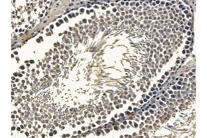 ABIN6259575 and ABIN6275740 at 1/100 staining rat testis tissue by IHC-P. (MNT anticorps  (Internal Region))