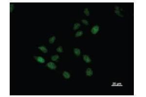 Immunostaining analysis in HeLa cells.
