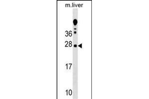 TRAT1 Antibody (Center) (ABIN1538723 and ABIN2848787) western blot analysis in mouse liver tissue lysates (35 μg/lane). (TRIM anticorps  (AA 98-127))