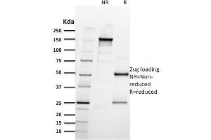 SDS-PAGE Analysis Purified CD61 Mouse Monoclonal Antibody (ITGB3/2597). (Integrin beta 3 anticorps  (AA 385-490))