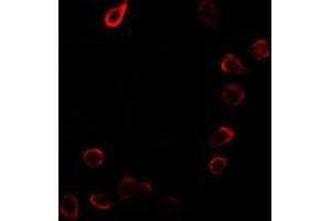 Immunofluorescent analysis of CDKN3 staining in MCF7 cells. (CDKN3 anticorps)