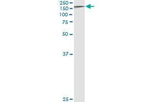 Immunoprecipitation of TYK2 transfected lysate using anti-TYK2 monoclonal antibody and Protein A Magnetic Bead , and immunoblotted with TYK2 MaxPab rabbit polyclonal antibody.