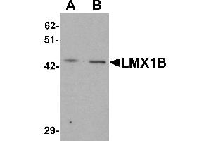 Western Blotting (WB) image for anti-LIM Homeobox Transcription Factor 1, beta (LMX1B) (C-Term) antibody (ABIN1077396)