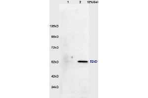 Lane 1: mouse lung lysates Lane 2: mouse brain lysates probed with Anti phospho-MAPKAPK5(Thr182) Polyclonal Antibody, Unconjugated (ABIN710546) at 1:200 in 4 °C.