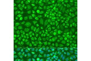 Immunofluorescence analysis of U2OS cells using DNAL1 Polyclonal Antibody at dilution of 1:100. (DNAL1 anticorps)
