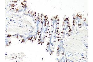 Immunohistochemistry of paraffin-embedded rat bronchial epithelium using PDCD1 antibody (ABIN6290170) at dilution of 1:100 (40x lens).