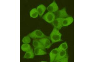 Immunocytochemistry staining of Hela cells fixed with 4 % Paraformaldehyde and using anti-Fatty Acid Synthase mouse mAb (dilution 1:400). (Fatty Acid Synthase anticorps)