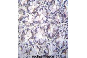 TBCA Antibody (Center) immunohistochemistry analysis in formalin fixed and paraffin embedded human rectum tissue followed by peroxidase conjugation of the secondary antibody and DAB staining.