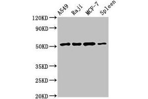 Western Blot Positive WB detected in: A549 whole cell lysate, Raji whole cell lysate, MCF-7 whole cell lysate, Rat spleen tissue All lanes: SERPINC1 antibody at 2. (SERPINC1 anticorps  (AA 37-180))