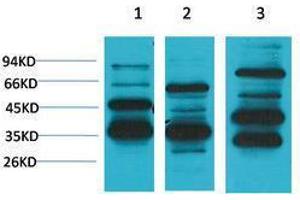Western Blotting (WB) image for anti-MAS1 Oncogene (MAS1) antibody (ABIN3179049) (MAS1 anticorps)